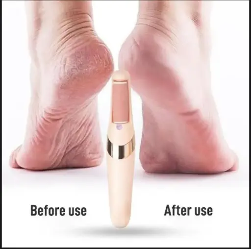 Electric Hard Skin Remover 